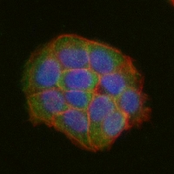 Clathrin Heavy Chain Rabbit Monoclonal Antibody