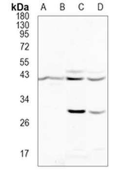 ACTR1B Rabbit Monoclonal Antibody
