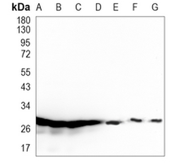 SNRPA1 Rabbit Monoclonal Antibody