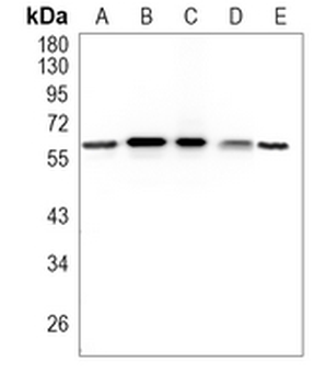 CLPX Rabbit Monoclonal Antibody