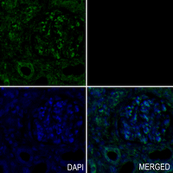 CLPX Rabbit Monoclonal Antibody