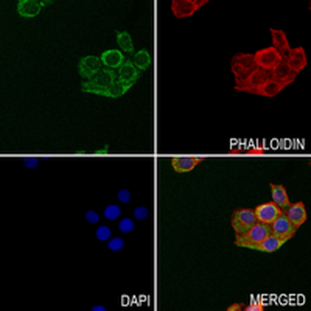 CLPX Rabbit Monoclonal Antibody