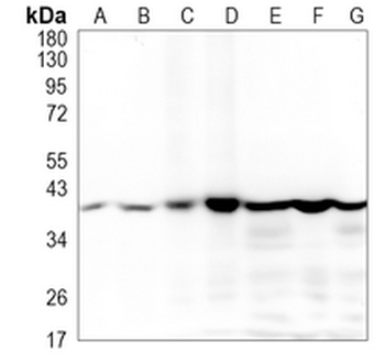 ACADS Rabbit Monoclonal Antibody