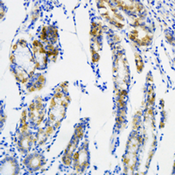 ACADS Rabbit Monoclonal Antibody