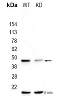 ACADS Rabbit Monoclonal Antibody