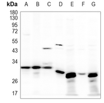 TPMT Rabbit Monoclonal Antibody