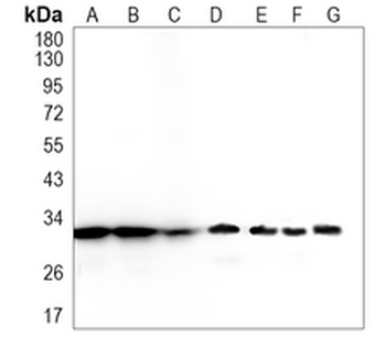 EF-Ts Rabbit Monoclonal Antibody