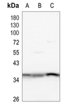 PP2A-alpha/beta Rabbit Monoclonal Antibody