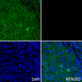 PP2A-alpha/beta Rabbit Monoclonal Antibody
