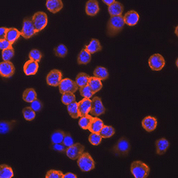 PP2A-alpha/beta Rabbit Monoclonal Antibody