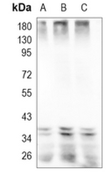 MKK3/6 Rabbit Monoclonal Antibody