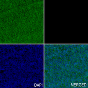 STOML2 Rabbit Monoclonal Antibody