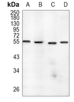 EOGT Rabbit Monoclonal Antibody