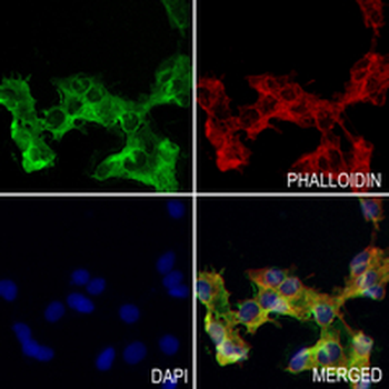 EOGT Rabbit Monoclonal Antibody