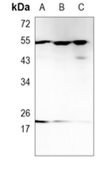 Vimentin Rabbit Monoclonal Antibody