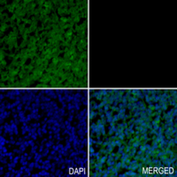 Vimentin Rabbit Monoclonal Antibody