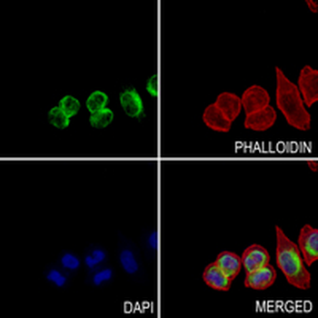 Vimentin Rabbit Monoclonal Antibody