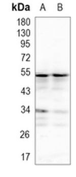 TEAD1/2/3/4 Rabbit Monoclonal Antibody