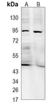 ODF2 Rabbit Monoclonal Antibody