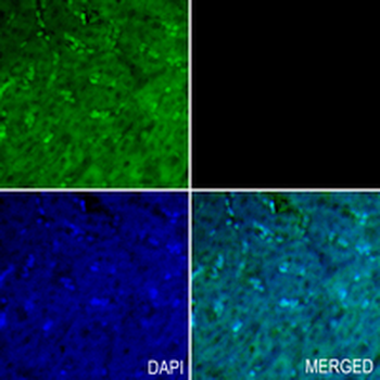 ODF2 Rabbit Monoclonal Antibody