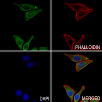 ODF2 Rabbit Monoclonal Antibody