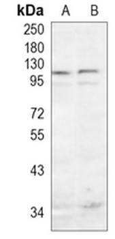 Catenin delta 1 Rabbit Monoclonal Antibody