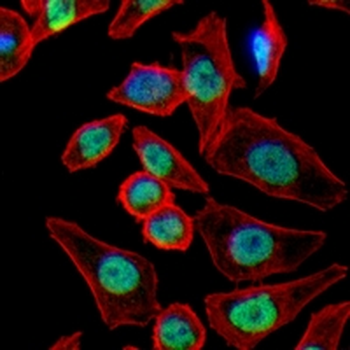 FOXF1 Rabbit Monoclonal Antibody