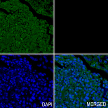 CRMP1 Rabbit Monoclonal Antibody