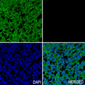 SRR Rabbit Monoclonal Antibody