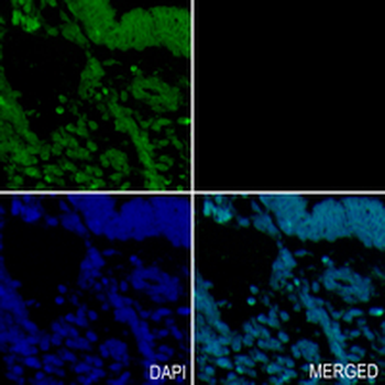 Paxillin Rabbit Monoclonal Antibody