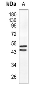 CLP1 Rabbit Monoclonal Antibody