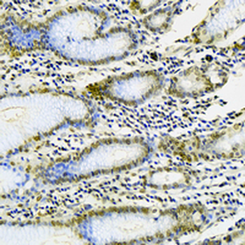 CLP1 Rabbit Monoclonal Antibody