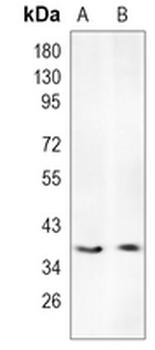Loricrin Rabbit Monoclonal Antibody