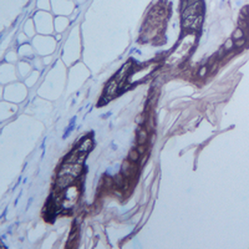 Loricrin Rabbit Monoclonal Antibody