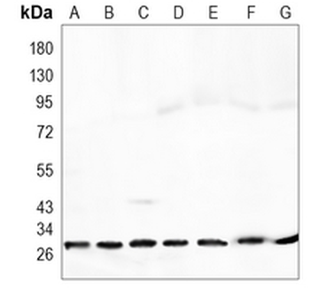 pro-NGF beta Rabbit Monoclonal Antibody