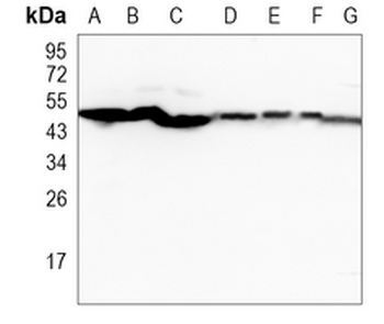 LOX Rabbit Monoclonal Antibody