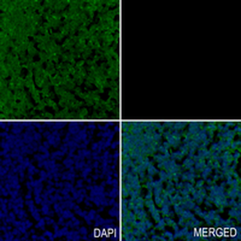 LOX Rabbit Monoclonal Antibody