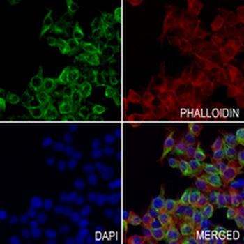 LOX Rabbit Monoclonal Antibody