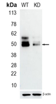 LOX Rabbit Monoclonal Antibody