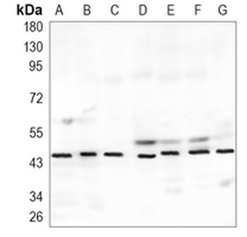 uPA Rabbit Monoclonal Antibody