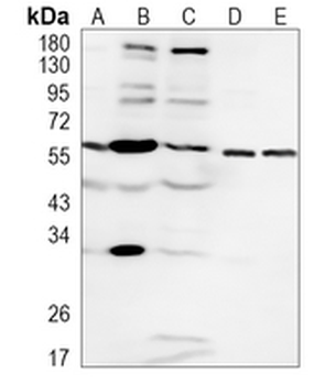 Estrogen Receptor alpha Rabbit Monoclonal Antibody