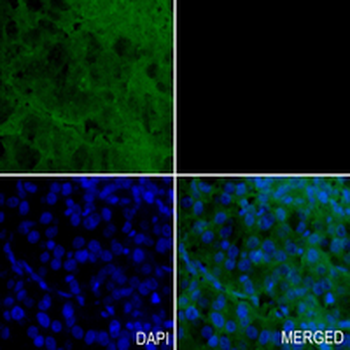 Estrogen Receptor alpha Rabbit Monoclonal Antibody