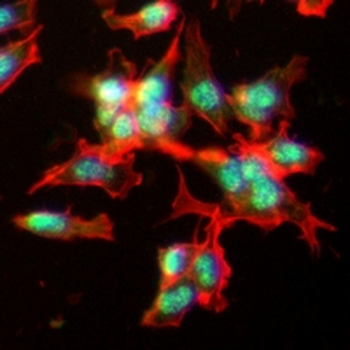 Estrogen Receptor alpha Rabbit Monoclonal Antibody