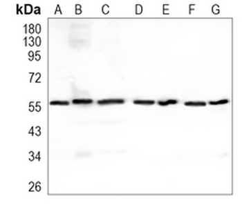 SOX10 Rabbit Monoclonal Antibody