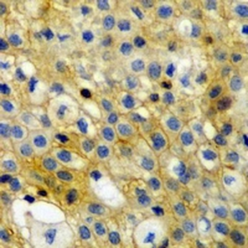 CD274 Rabbit Monoclonal Antibody