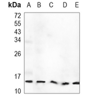 H-FABP Rabbit Monoclonal Antibody