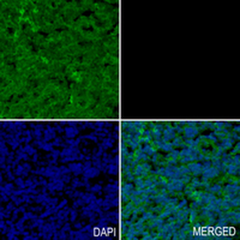XDH Rabbit Monoclonal Antibody