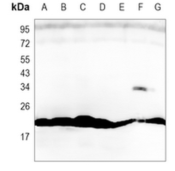 IL-1RA Rabbit Monoclonal Antibody