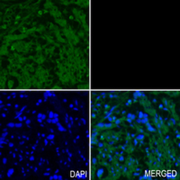 IL-1RA Rabbit Monoclonal Antibody