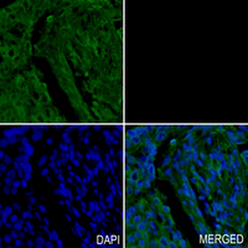 GAP43 Rabbit Monoclonal Antibody